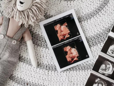 Everything you need to know about the 3 ultrasounds of your pregnancy