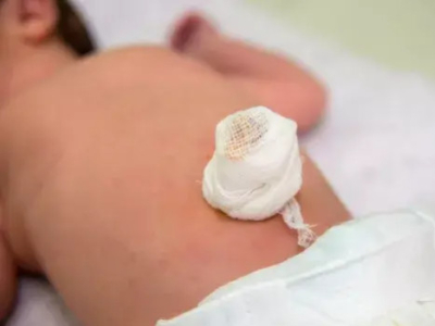Baby's umbilical cord care